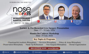 Nose by FAT Conference - SPE